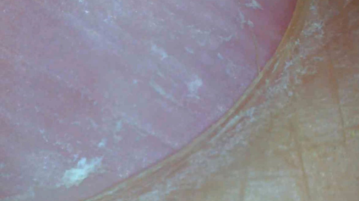 zoom in of nail, showing both nail and skin next to it